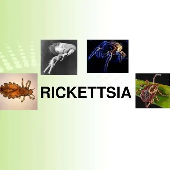 Ricketsia (Typhus Fever) IgG and IgM Antibodies Test
